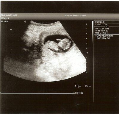 Baby207